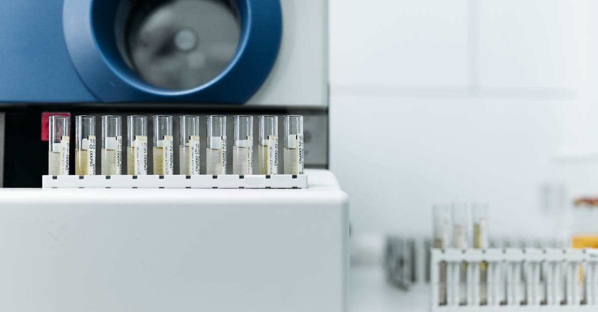 SAPs KI-Offensive: Prior Labs als strategischer Baustein